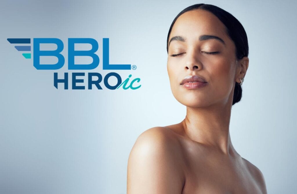 BBL HEROic skin Treatment