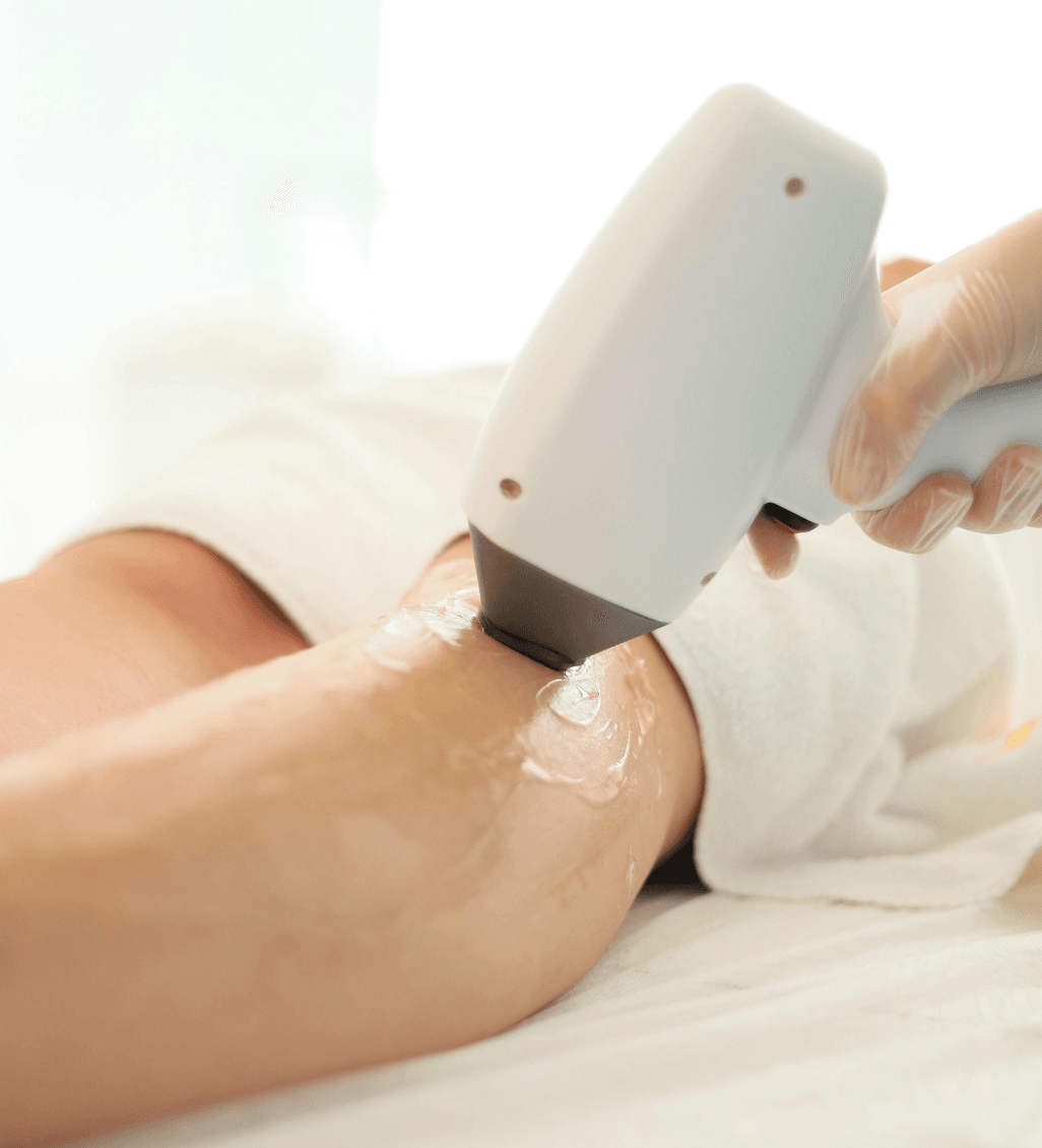 Viora ST Skin Tightening