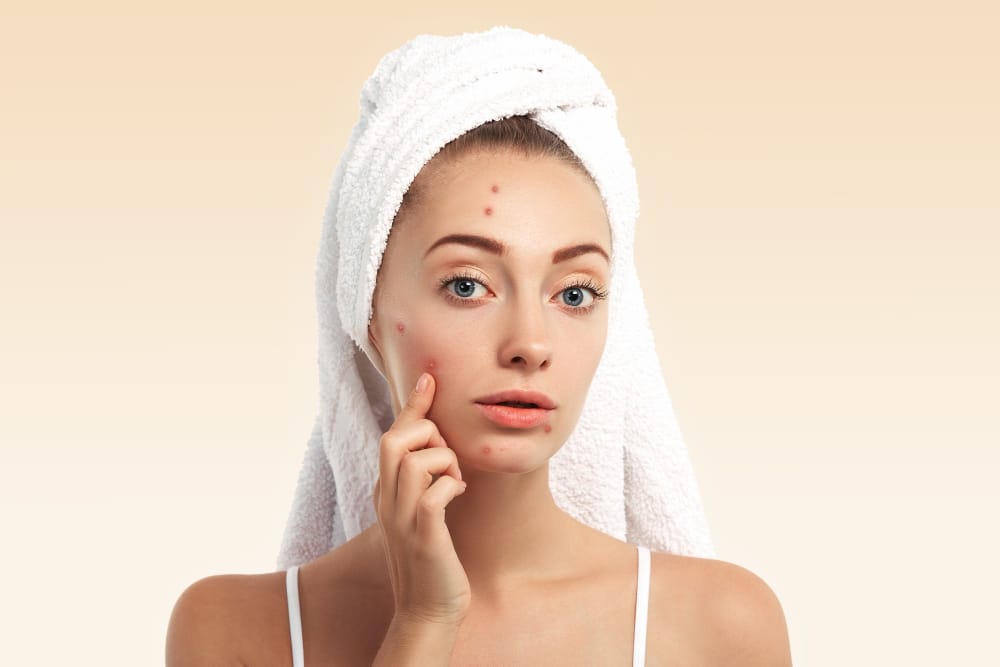 pigmentation treatment clinic in Dubai