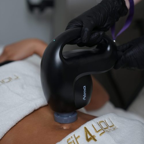 Alma Primex Vertical